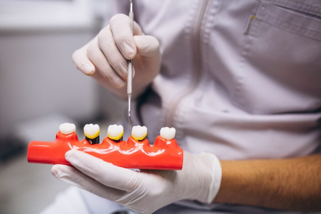 dentist holding teeth sample
